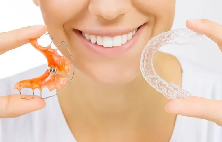 Co to jest Invisalign?