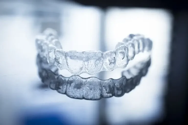 Invisalign czas leczenia