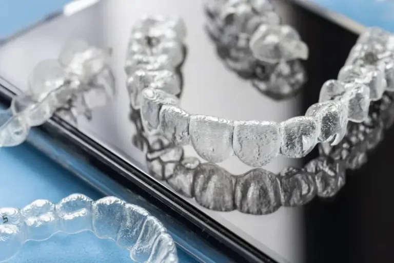 Nakładki ortodontyczne Invisalign