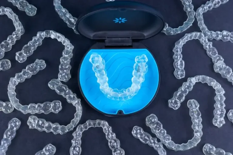 Po jakim czasie efekty Invisalign?